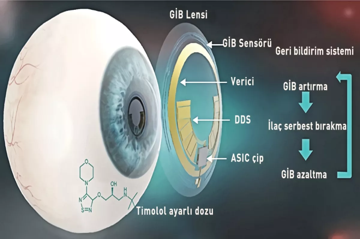 Glokomu teşhis ve tedavi eden akıllı lens